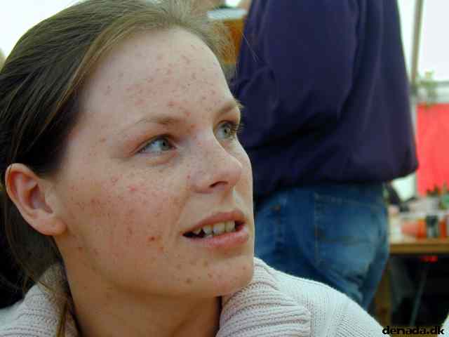 * Image 9