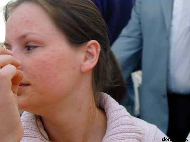 * Image 12