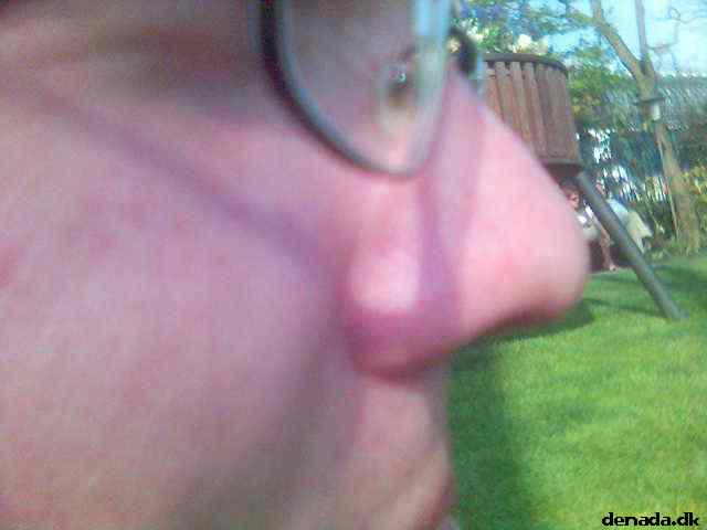* Image 25