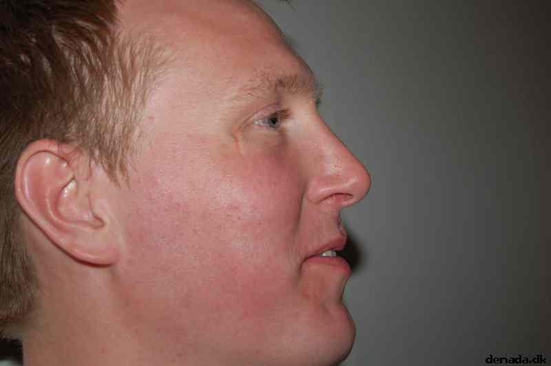 * Image 18