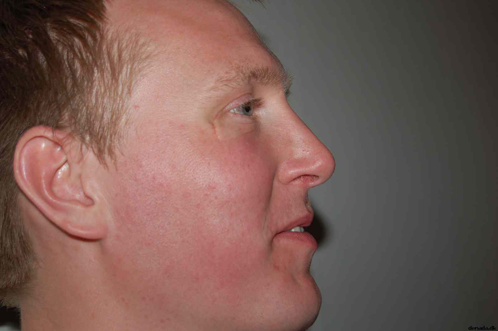 * Image 18